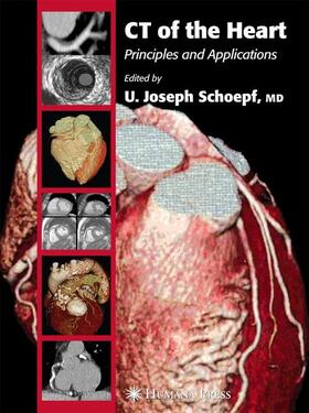 Schoepf |  CT of the Heart | Buch |  Sack Fachmedien