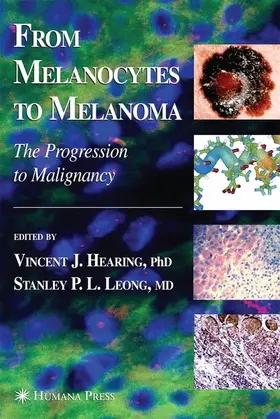 Hearing / Leong |  From Melanocytes to Melanoma | Buch |  Sack Fachmedien