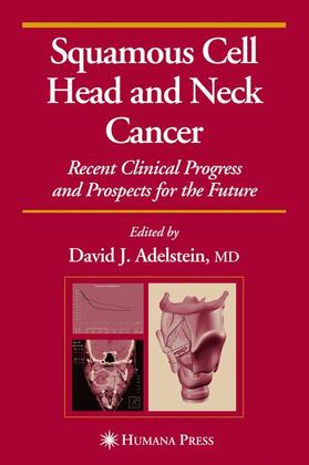 Adelstein |  Squamous Cell Head and Neck Cancer | Buch |  Sack Fachmedien