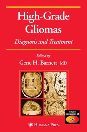 Barnett |  High-Grade Gliomas | Buch |  Sack Fachmedien