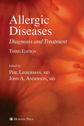 Anderson / Lieberman |  Allergic Diseases | Buch |  Sack Fachmedien