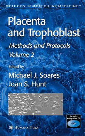 Soares / Hunt |  Placenta and Trophoblast | Buch |  Sack Fachmedien