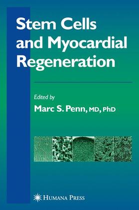 Penn |  Stem Cells and Myocardial Regeneration | Buch |  Sack Fachmedien