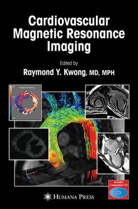 Kwong |  Cardiovascular Magnetic Resonance Imaging | Buch |  Sack Fachmedien