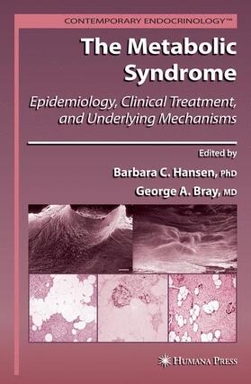Bray / Hansen |  The Metabolic Syndrome: | Buch |  Sack Fachmedien