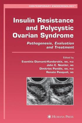 Diamanti-Kandarakis / Pasquali / Nestler |  Insulin Resistance and Polycystic Ovarian Syndrome | Buch |  Sack Fachmedien
