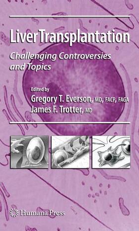 Everson / Trotter |  Liver Transplantation | Buch |  Sack Fachmedien