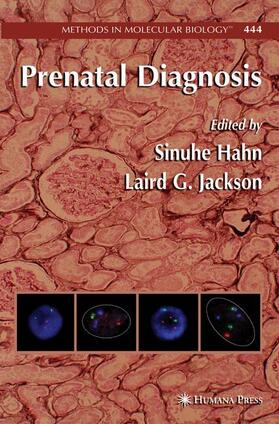 Jackson / Hahn |  Prenatal Diagnosis | Buch |  Sack Fachmedien