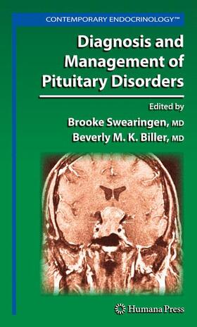 Biller / Swearingen |  Diagnosis and Management of Pituitary Disorders | Buch |  Sack Fachmedien