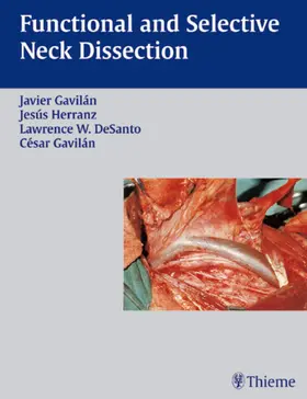 Gavilan / De Santo |  Functional and Selective Neck Dissection | Buch |  Sack Fachmedien