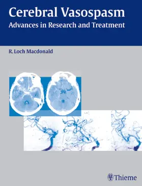 Macdonald |  Cerebral Vasospasm | Buch |  Sack Fachmedien