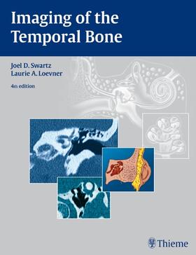 Swartz / Loevner |  Imaging of the Temporal Bone | Buch |  Sack Fachmedien