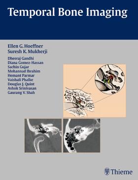 Hoeffner / Shah / Mukherji |  Temporal Bone Imaging | Buch |  Sack Fachmedien