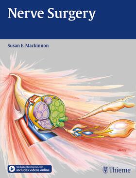 Mackinnon |  Nerve Surgery | Buch |  Sack Fachmedien