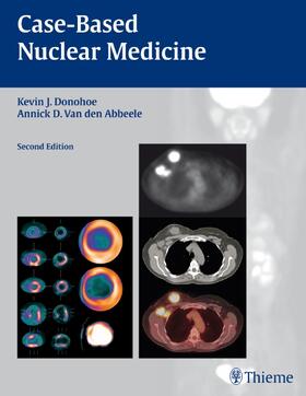 Donohoe / Abbeele / Van den Abbeele |  Case-Based Nuclear Medicine | Buch |  Sack Fachmedien