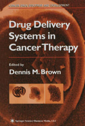 Brown |  Drug Delivery Systems in Cancer Therapy | eBook | Sack Fachmedien