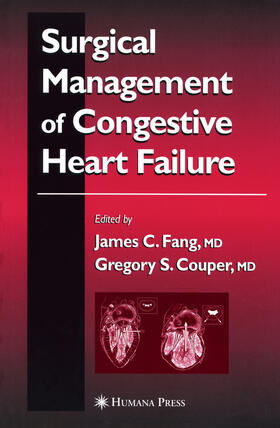 Fang / Couper | Surgical Management of Congestive Heart Failure | E-Book | sack.de