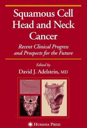 Adelstein |  Squamous Cell Head and Neck Cancer | eBook | Sack Fachmedien