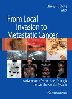 Leong |  From Local Invasion to Metastatic Cancer | Buch |  Sack Fachmedien