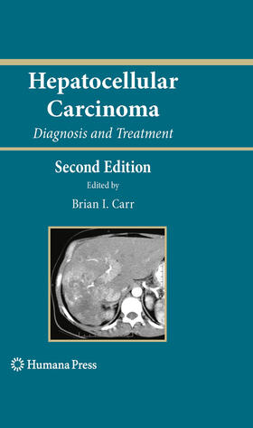 Carr |  Hepatocellular Carcinoma | eBook | Sack Fachmedien