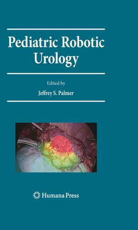 Palmer |  Pediatric Robotic Urology | eBook | Sack Fachmedien