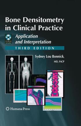 Bonnick |  Bone Densitometry in Clinical Practice | Buch |  Sack Fachmedien