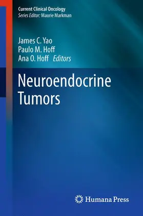 Yao / Hoff |  Neuroendocrine Tumors | Buch |  Sack Fachmedien