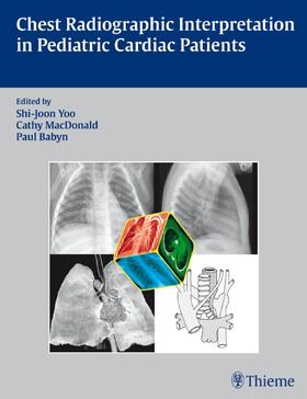 Yoo / MacDonald / Babyn |  Chest Radiographic Interpretation in Pediatric Cardiac Patients | Buch |  Sack Fachmedien
