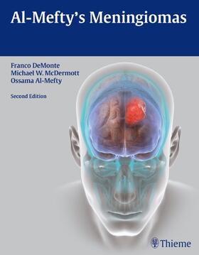 DeMonte / McDermott / Al-Mefty |  Al-Mefty's Meningiomas | Buch |  Sack Fachmedien