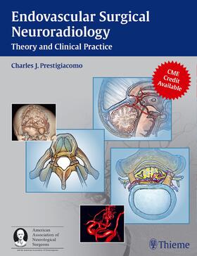 Prestigiacomo |  Endovascular Surgical Neuroradiology | Buch |  Sack Fachmedien