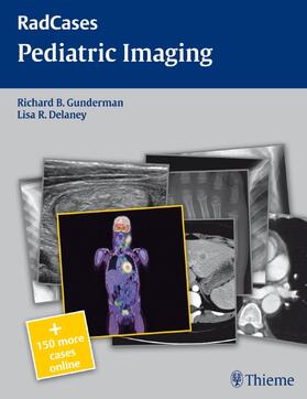 Gunderman / Delaney |  Radcases Pediatric Imaging [With Access Code] | Buch |  Sack Fachmedien