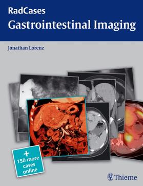 Lorenz |  Gastrointestinal Imaging | Buch |  Sack Fachmedien