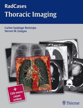 Restrepo / Zangan |  Radcases Thoracic Imaging | Buch |  Sack Fachmedien
