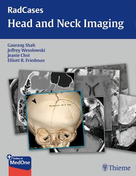Shah / Wesolowski / Choi |  RadCases Head and Neck Imaging | Buch |  Sack Fachmedien
