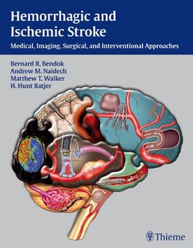 Bendok / Naidech / Batjer |  Hemorrhagic and Ischemic Stroke | Buch |  Sack Fachmedien