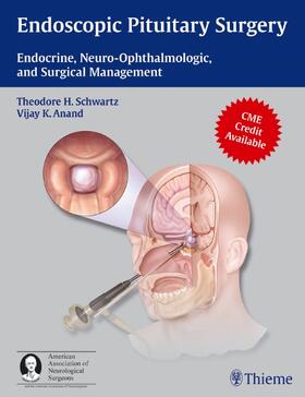 Schwartz / Anand |  Endoscopic Pituitary Surgery | Buch |  Sack Fachmedien