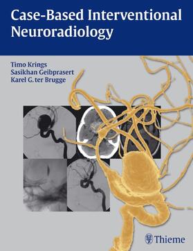 Krings / Geibprasert / ter Brugge |  Case-Based Interventional Neuroradiology | Buch |  Sack Fachmedien