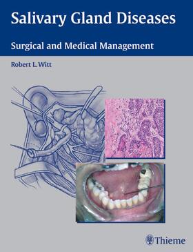 Witt |  Salivary Gland Diseases | eBook | Sack Fachmedien