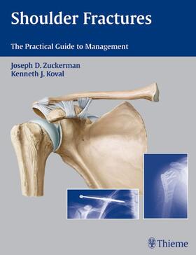 Zuckerman / Koval |  Shoulder Fractures | eBook | Sack Fachmedien