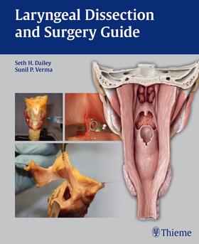 Dailey / Verma |  Laryngeal Dissection and Surgery Guide | Buch |  Sack Fachmedien