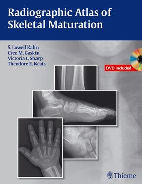 Kahn / Gaskin / Sharp |  Radiographic Atlas of Skeletal Maturation | eBook | Sack Fachmedien