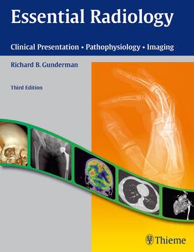 Gunderman |  Essential Radiology | eBook | Sack Fachmedien