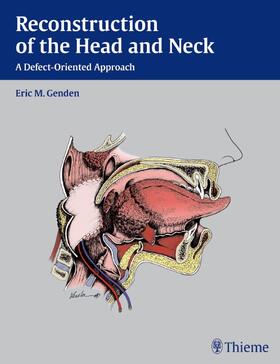 Genden |  Reconstruction of the Head and Neck | Buch |  Sack Fachmedien
