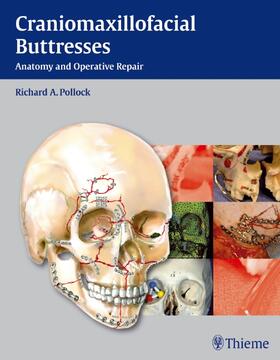 Pollock |  Craniomaxillofacial Buttresses | eBook | Sack Fachmedien