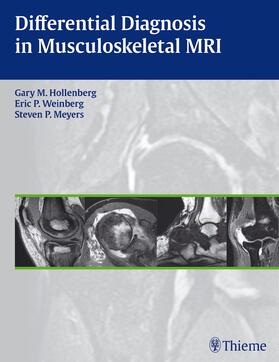 Hollenberg / Weinberg / Meyers |  Differential Diagnosis in Musculoskeletal MR | Buch |  Sack Fachmedien