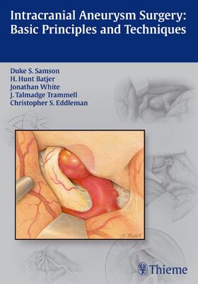Samson / Batjer / White |  Intracranial Aneurysm Surgery | eBook | Sack Fachmedien