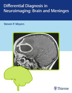 Meyers |  Differential Diagnosis in Neuroimaging: Brain and Meninges | Buch |  Sack Fachmedien