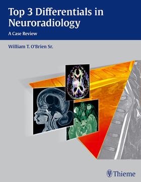 O'Brien |  Top 3 Differentials in Neuroradiology | Buch |  Sack Fachmedien