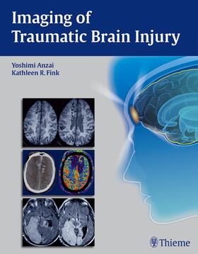 Anzai / Fink |  Imaging of Traumatic Brain Injury | Buch |  Sack Fachmedien