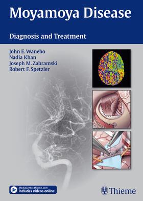 Wanebo / Khan / Zabramski |  Moyamoya Disease | Buch |  Sack Fachmedien